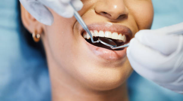 Best Emergency Root Canal Treatment in Burns Harbor, IN